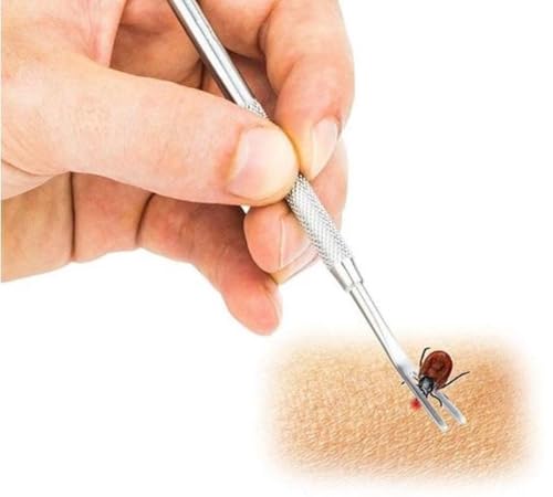 CHPN - Zeichnenzange - Zeichnen von Pinzetten - Tick -Werkzeug - Teek -Entferner - Haustiere und Menschen - Teek Entfernen - Lyme - Edelstahl CHPN - Zeichnenzange - Zeichnen von Pinzetten - Tick -Werkzeug - Teek -Entferner - Haustiere und Menschen - Teek Entfernen - Lyme - Edelstahl von CHPN