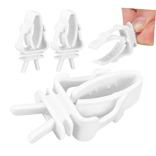 IMIKEYA 4Stücke Bird Cage Food Holder Clips Durable Plastic Parrot Cage Feeding Clamps Easy Installation Birdcage Accessories for Parrots and Budgies von IMIKEYA