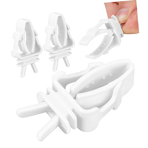 Milisten 4 Stück Vogelkäfig Klammer Vogelfutter Clips Vogelkäfig Zubehör Für Sittiche Haustier Futterspender Clip Vogelfutter Halter Vogelkäfig Halter Sittich Futter Clips von Milisten
