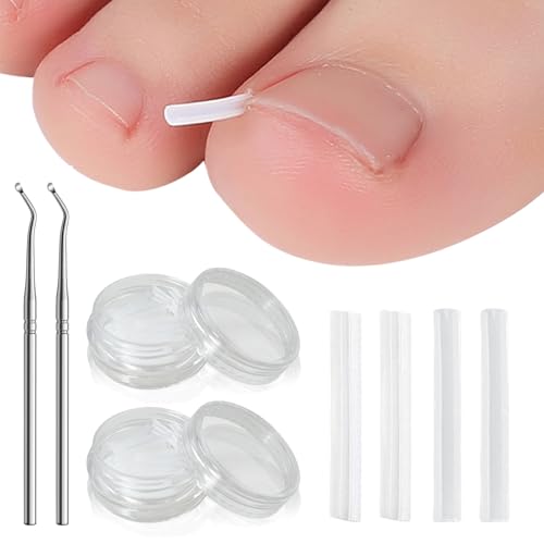 UILYNIU 102 Stücke Set zur Korrektur Eingewachsener Zehennägel, Nagelfalztamponade Rohr, Zehennagelkorrektur für Eingewachsene Zehennägel, Korrektor Werkzeugen für Fußpflege Behandlung (Transparent) UILYNIU 102 Stücke Set zur Korrektur Eingewachsener Zehennägel, Nagelfalztamponade Rohr, Zehennagelkorrektur für Eingewachsene Zehennägel, Korrektor Werkzeugen für Fußpflege Behandlung (Transparent) von UILYNIU